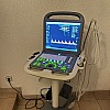 SonoScape S2 Farbdoppler, Ultraschall